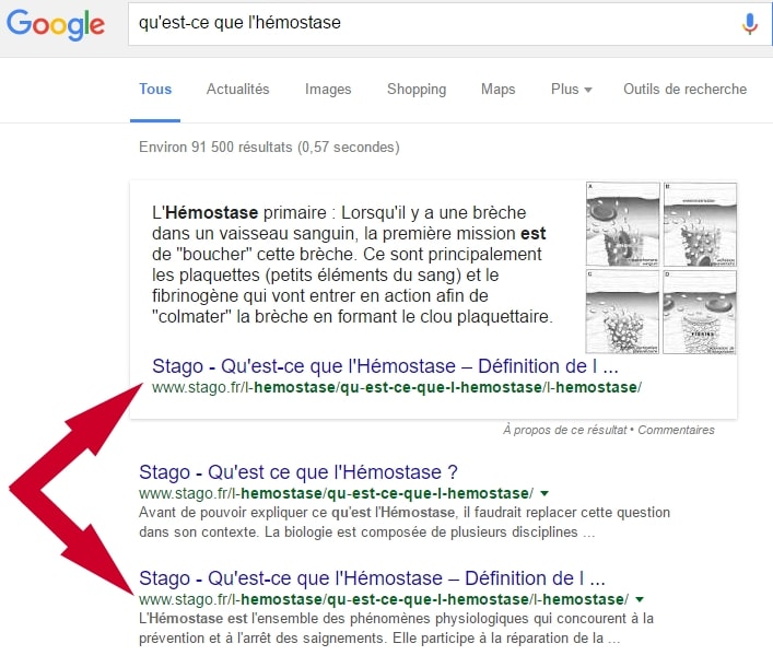 Capture d'écran d'un extrait optimisé ou featuerd snippet dans les résultats de Google